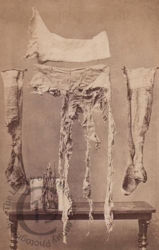 Badly damaged clothing