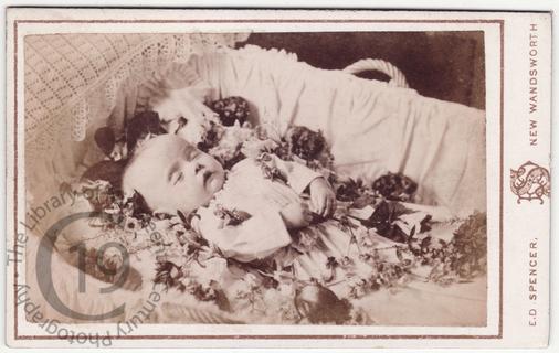 A dead baby